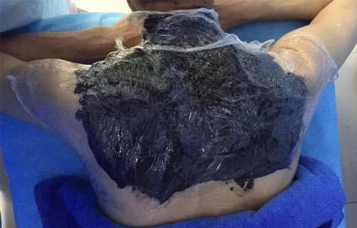 独创四联疗法专治肩周炎，7天康复！中文成人网
平阳部骨科火了！